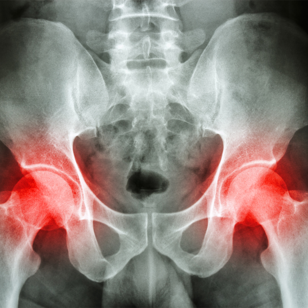 orthopedie brest infos medicales hanche header