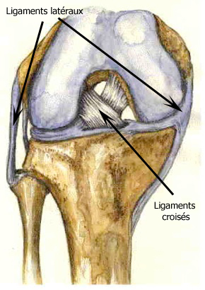 Entorse du genou