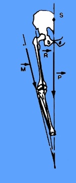 L'ostéotomie tibiale de valgisation